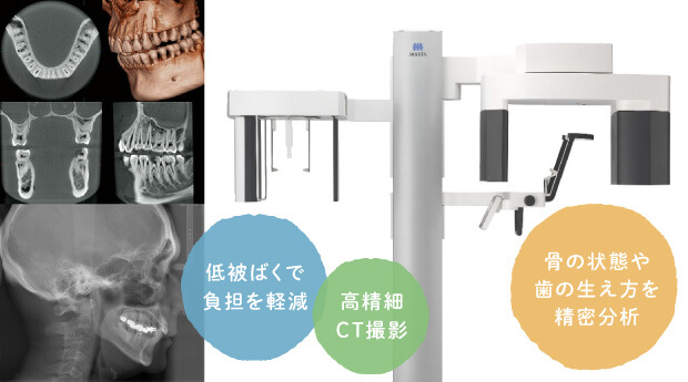 骨の状態や歯の生え方を精密分析